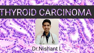 THYROID CARCINOMA  The White Army Webinar [upl. by Aitnic]