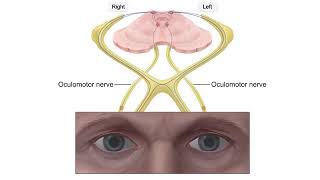 Normal pupillary light reflex [upl. by Stubbs266]