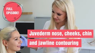 Amazing Beauty Hack Juvederm Redefines Nose Cheeks amp Jawline [upl. by Cerallua843]