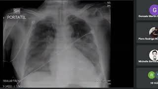 Fisiopatología de la insuficiencia cardiaca Izquierda y Cor Pulmonale UNIDAD III [upl. by Elledoj859]