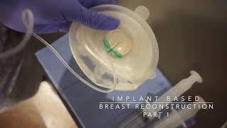 Breast Reconstruction After Mastectomy with Tissue Expanders  Dr Amaka explains the process [upl. by Cram]