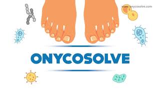 OnycoSolve  A Powerful Weapon Against Feet Fungus [upl. by Milks19]