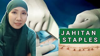 LEBIH MENGENAL JAHITAN STAPLES UNTUK LUKA OPERASI [upl. by Ikkiv231]