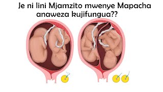 Je Mama Mjamzito mwenye Mapacha anaweza kujifungua wiki ya ngapi Uchungu wa kawaida huanza lini [upl. by Demmahum]