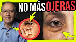 👁️ OLVIDATE De Las OJERAS Con SOLUCIONES EFECTIVAS Y NATURALES  Oswaldo Restrepo RSC [upl. by Ikceb299]