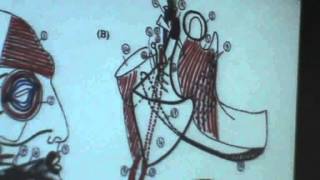 5 DrAhmed Galal 19102014  Parotid gland [upl. by Neelat]