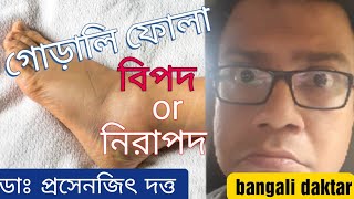 ankle swelling গোড়ালি ফোলা বিপজ্জনক না সাধারণ বুঝবেন কি করে causes symptomsdiagnosis [upl. by Leod]