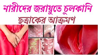 নারীদের জরায়ুতে চুলকানি  Econate VT Vaginal Tablet  Econazole Nitrate  Vaginal Tablet [upl. by Adnic]