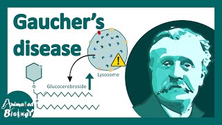 Gauchers disease  classification symptoms pathology of Gauchers disease [upl. by Eninahpets]