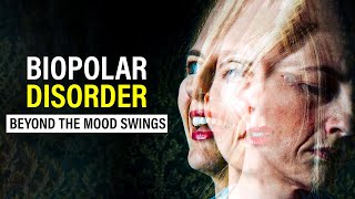 Bipolar Disorder  Mental Health  Healing Mind [upl. by Blau]