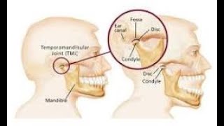 Botulinum Toxin Type A Injection ZARBOT Therapy for Temporomandibular DisorderOrofacial Pain [upl. by Nalced163]