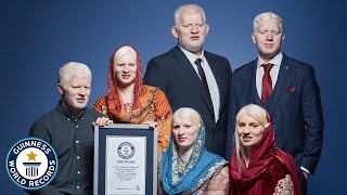 Were Asian Albino and Beautiful  Guinness World Records [upl. by Narut]