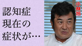 小林旭の“認知症”と言われる現在…美空ひばりとの離婚理由に言葉を失う…「仁義なき戦い」でも有名な俳優の“黒い組織”との関係に驚きを隠せない… [upl. by Kinnon102]