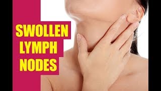 Immune System 5 Home Remedies for Swollen Lymph Nodes  By Top 5 [upl. by Irrahs]