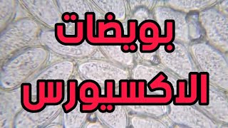 يرقة الاكسيورس تتحرك داخل البويضة [upl. by Eikram]