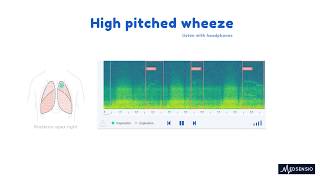 Lung sounds  High pitched wheeze [upl. by Auburn842]