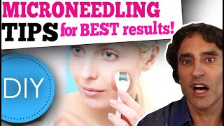 MICRONEEDLING DIY at HOME  What You Need to Know [upl. by O'Donoghue392]