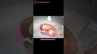 What is an amniocentesis  Amniotic fluid check up [upl. by Leinehtan]