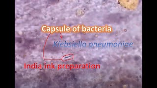 India ink preparation showing capsule of bacteria [upl. by Terese415]