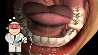 Why Partial Denture turn often in Total Denture total prothesis [upl. by Akilam317]