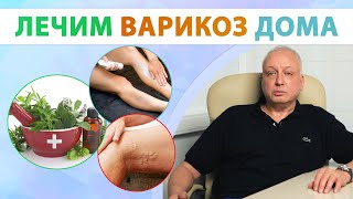 Как вылечить варикоз Чего делать нельзя [upl. by Jalbert]