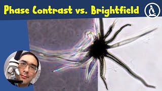 🔬 Brightfield vs Phase Contrast Microscopy Compared  Amateur Microscopy [upl. by Nilre]