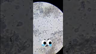 Curd 😰🤯 Under the microscope foryou Viral trending foryoup [upl. by Irakab]