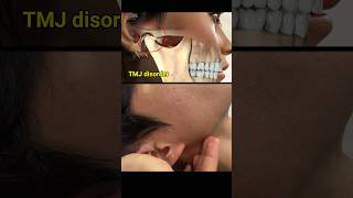 Temporomandibular joint disorder and treatment tmj dental dentist [upl. by Ttelrahc513]