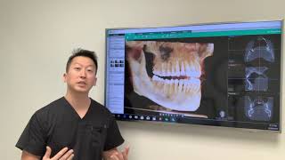 IV Sedation vs Oral Sedation [upl. by Ecar307]