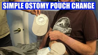 Changing a colostomy bag  quick and easy [upl. by Elena]