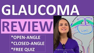 PRIMARY ANGLE CLOSURE GLAUCOMA  Ophthalmology lectures  NEET PG NOTES [upl. by Robbie]