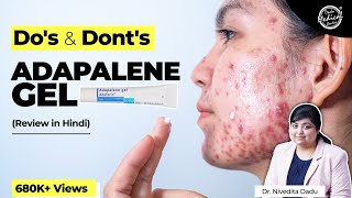 Adapalene Gel Review  Adapalene Gel 01  How to Use Adapalene Gel 01  Dr Nivedita Dadu [upl. by Suivatna]