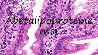 How to Pronounce Abetalipoproteinemia [upl. by Enyalb]