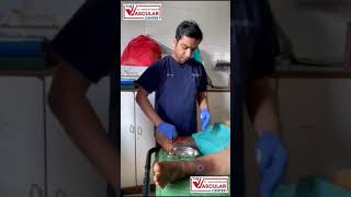 How To Do Dressing of Varicose Ulcer  Dr Ashank Bansal mumbai ulcertreatment [upl. by Nahshu411]