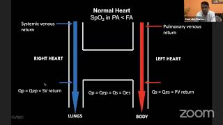 Webinar 1 cyanotic congenital heart disease [upl. by Htenaj]