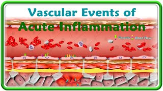 2 Vascular events of Acute Inflammation  Animation [upl. by Isiah]