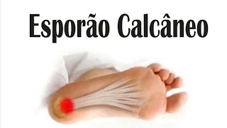 Esporão Calcâneo  Sintomas Causas e Tratamento  Dr Noé de Toledo esporãodecalcâneo [upl. by Robinetta]