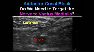 Adductor Canal Block  Does Nerve to Vastus Medialis Have To Be SEPARATELY Targeted [upl. by Nerual924]