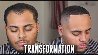 HAIRCUT TRANSFORMATION  Receding Hairline amp Widows Peak Tips HD [upl. by Magda]