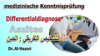 Aszites Bauchwassersucht Differentialdiagnose  التشخيص التفريقي  الحبن [upl. by Ehsrop]