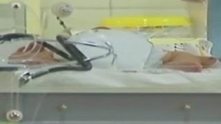 Baby found alive in morgue [upl. by Nerok973]