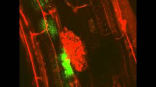 Arbuscular Mycorrhizal Symbiosis VESICLE Live Imaging [upl. by Iolanthe680]