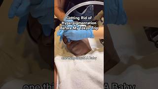 Does Microdermabrasion work on dark skin [upl. by Barnet794]