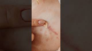 Identifying Common Skin Rashes and How to Treat Them [upl. by Imailiv]