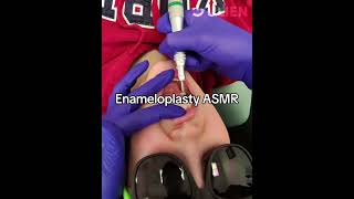 This Dental Procedure Will Tingle Your Senses [upl. by Nylevol891]