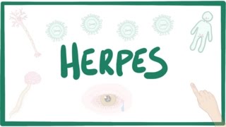 Herpes oral amp genital  causes symptoms diagnosis treatment pathology [upl. by Lonier]