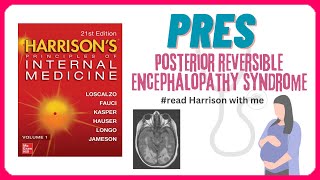 Posterior Reversible Encephalopathy Syndrome  PRES  Causes  Pathophysiology  Management [upl. by Bernadene]