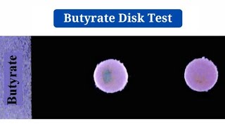 Butyrate Disk Test biochemical test lecture 20 [upl. by Adnicul734]