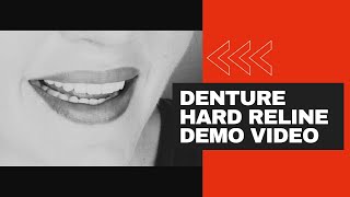 Denture procedure hard reline demo video [upl. by Hgeilhsa]