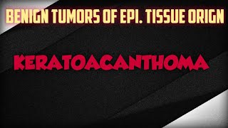 KERATOACANTHOMA  BENIGN EPI TUMOR [upl. by Ycart38]